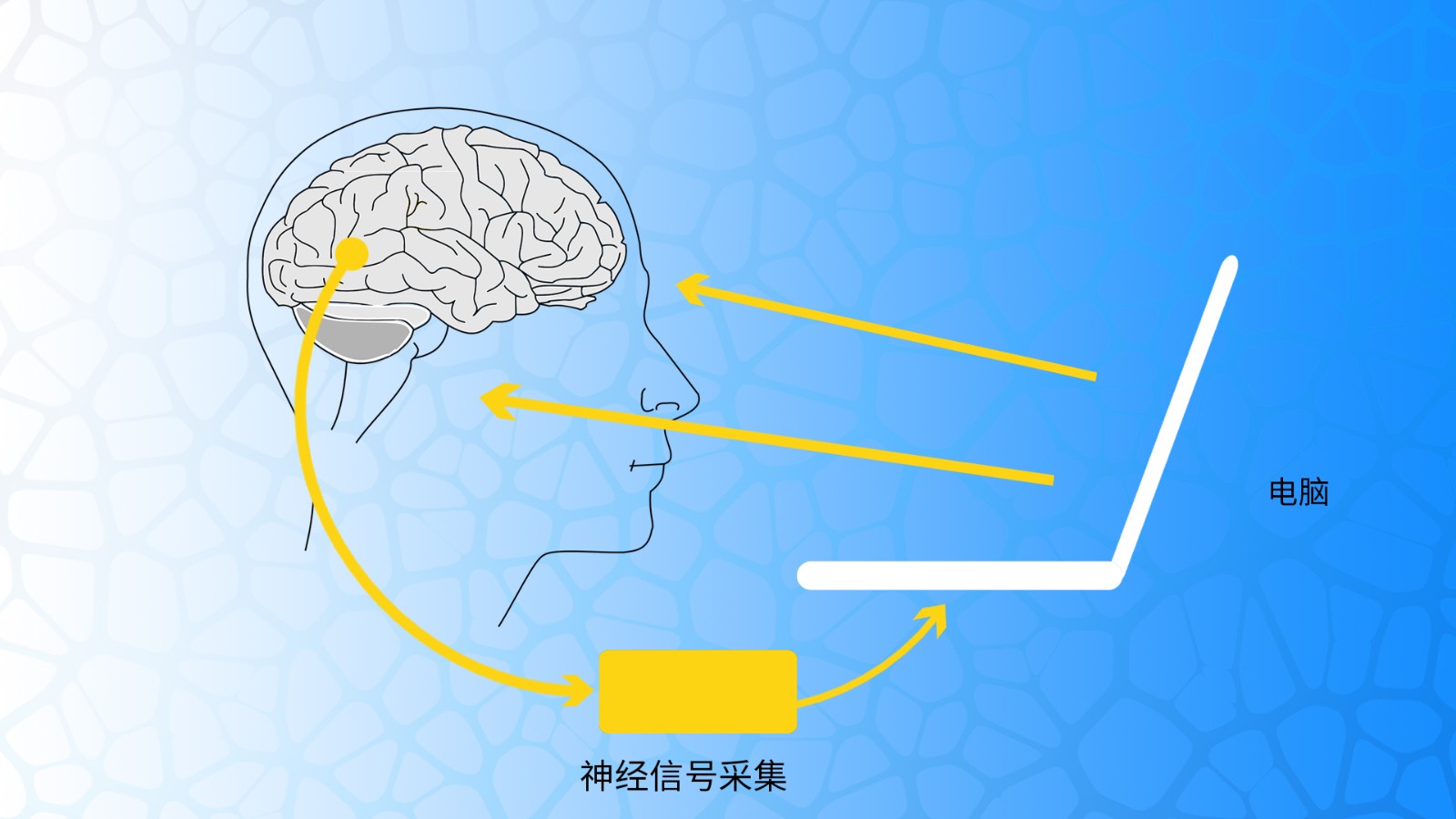 腦電在神經(jīng)生物反饋中的應用